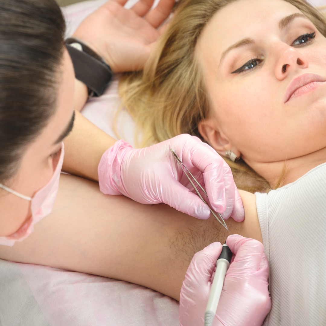 microneedling docteur nativelle lisieux deauville médecine esthétique et vasculaire